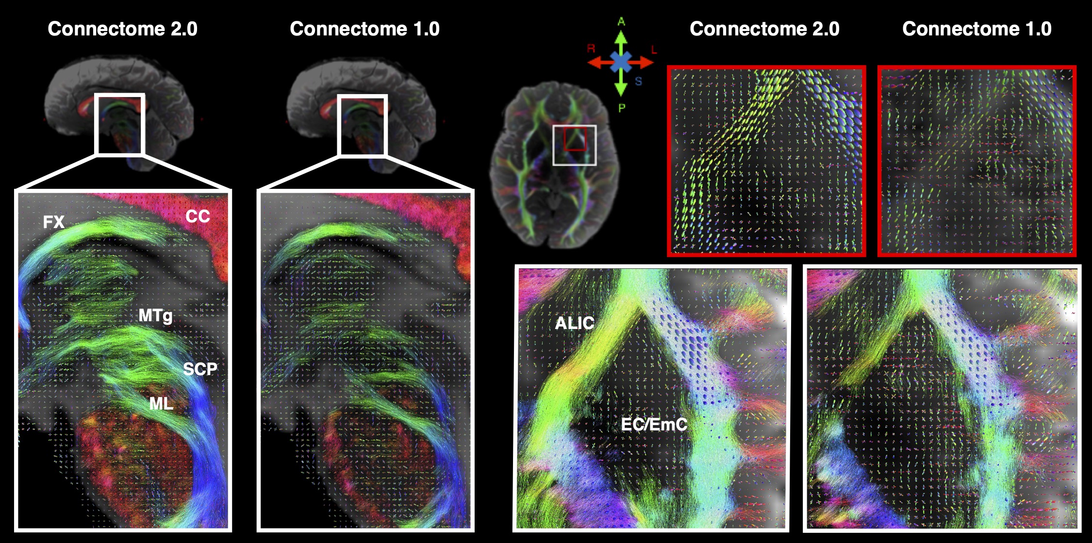 Another Leap Forward in Connectome Imaging of the Brain – Martinos Center